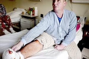 Turėjo pagyti, bet neteko dalies pėdos. Ligoninė kaltės neįžvelgia