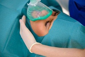 Dantų implantai – kuo tikėti ir kuo ne?