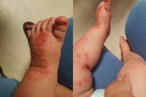 Karti mamos patirtis parodė: kūdikių geriau nebučiuoti