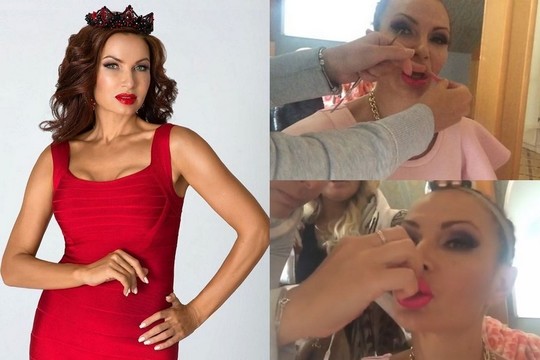 Rusijos žvaigždė šokiruoja: kad galėtų pavalgyti, jai nuplėšiamos lūpos