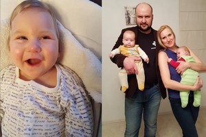 Po dvynukų gimimo – šokas tėvams: vienas iš kūdikių ėmė žaliuoti