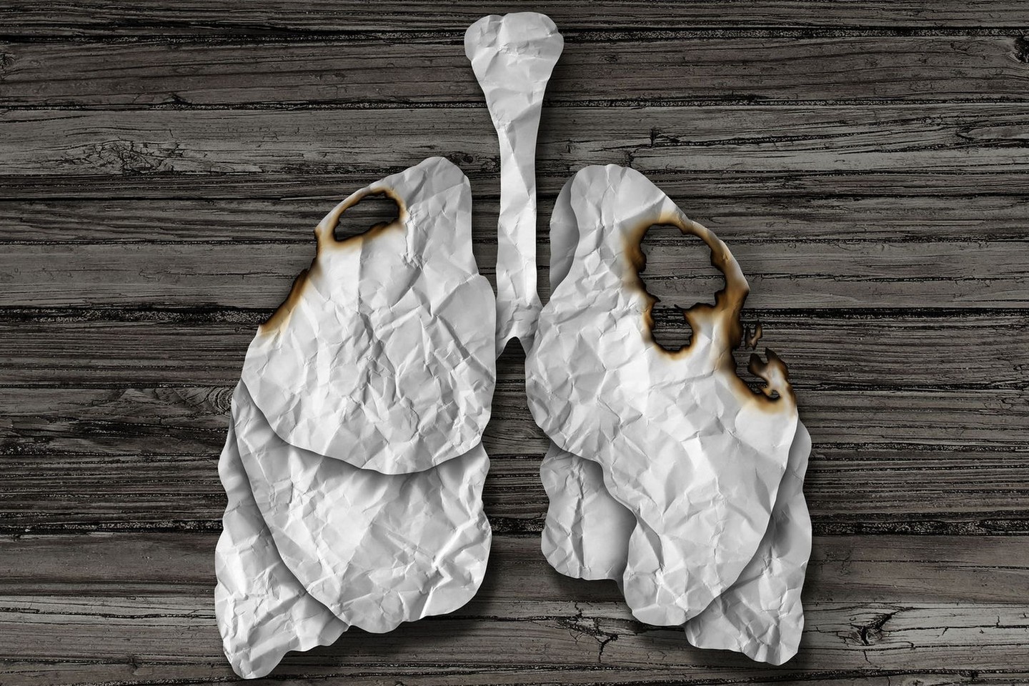 Adenokarcinoma (plaučių  vėžys) plinta išorinėje plaučių dalyje.<br>123rf nuotr.