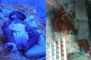 Dviem jonaviškių vaikams – baisūs išbandymai vos gimus