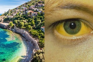 Perspėja visus: po atostogų užsienyje parsivežė sunkią ligą