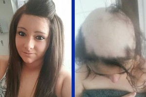 Mergina susirgo neįprasta liga, kurios priežastimi tapo jos vaikinas