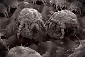 Kamuoja čiaudulys ir sloga? Gali būti, kad jūsų namuose yra nekviestų svečių