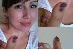 Ženklas ant moters nykščio slėpė žiaurią tiesą