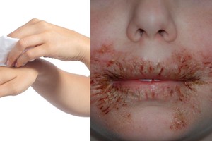 Perspėjo: nustokite švarintis tokiomis priemonėmis