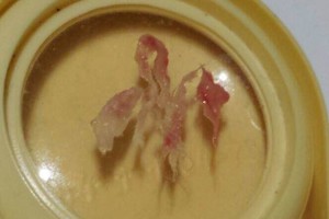 Radinys burnoje po dantų rovimo: „Ašaros riedėjo iš gailesčio sau“