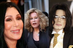 Atima žadą: kiek kainavo brangiausios žvaigždžių operacijos?