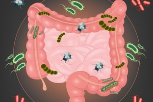 Iš jūsų organizmo reika valyti toksinus, jei pastebite šiuos požymius