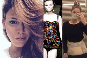 Dainininkė Dileta Meškaitė-Kisielienė patyrė rimtą stuburo traumą