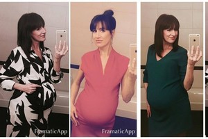 Devintą mėnesį nėščia Katažina Zvonkuvienė klausia patarimo dėl suknelės