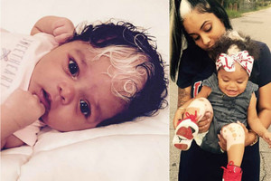 Mamą trikdo smalsių praeivių klausimai apie dukters išvaizdą