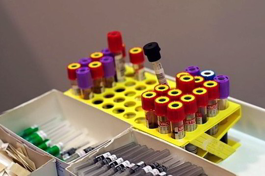 Padidėjęs cholesterolis – sunkių ligų pranašas?