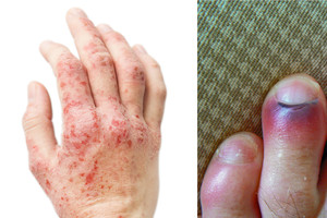 Specialistė įspėjo: tai gali nutikti bet kuriam iš mūsų