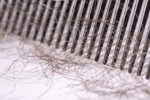 Net neįtarėte, kad visi šie požymiai byloja apie nusilpusį imunitetą