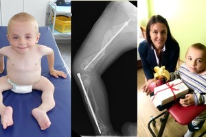 Reta liga sergančio devynmečio gyvenime – stebuklas po stebuklo