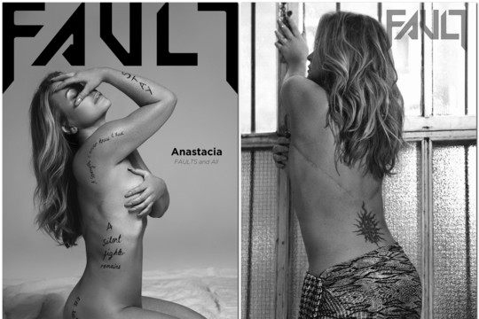 Vėžį įveikusi dainininkė Anastacia apnuogino ir kūną, ir sielą