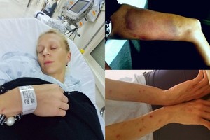 Erika Santos atskleidė, kad sunkiai serga, ir pasidalijo šiurpiomis nuotraukomis