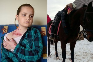 Itin reta odos liga sergančios mergaitės šeimai – širdį draskanti žinia