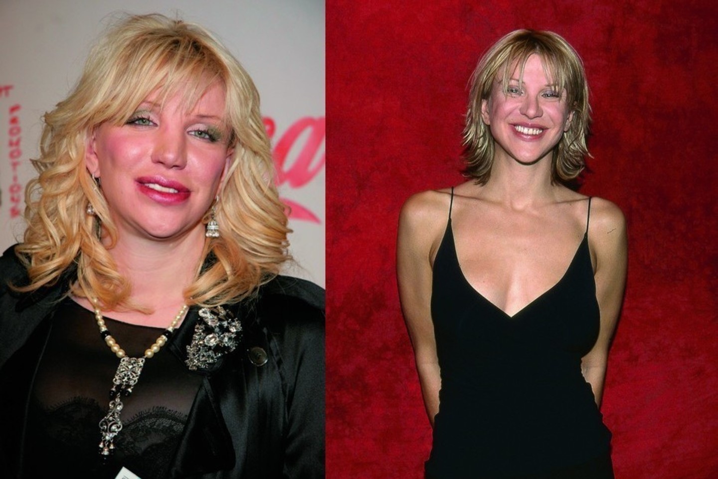 Buvusiai dainininko Kurto Cobaino žmonai aktorei Courtney Love specialistai padailino ir jos dantis.<br>ViDA Press nuotr.