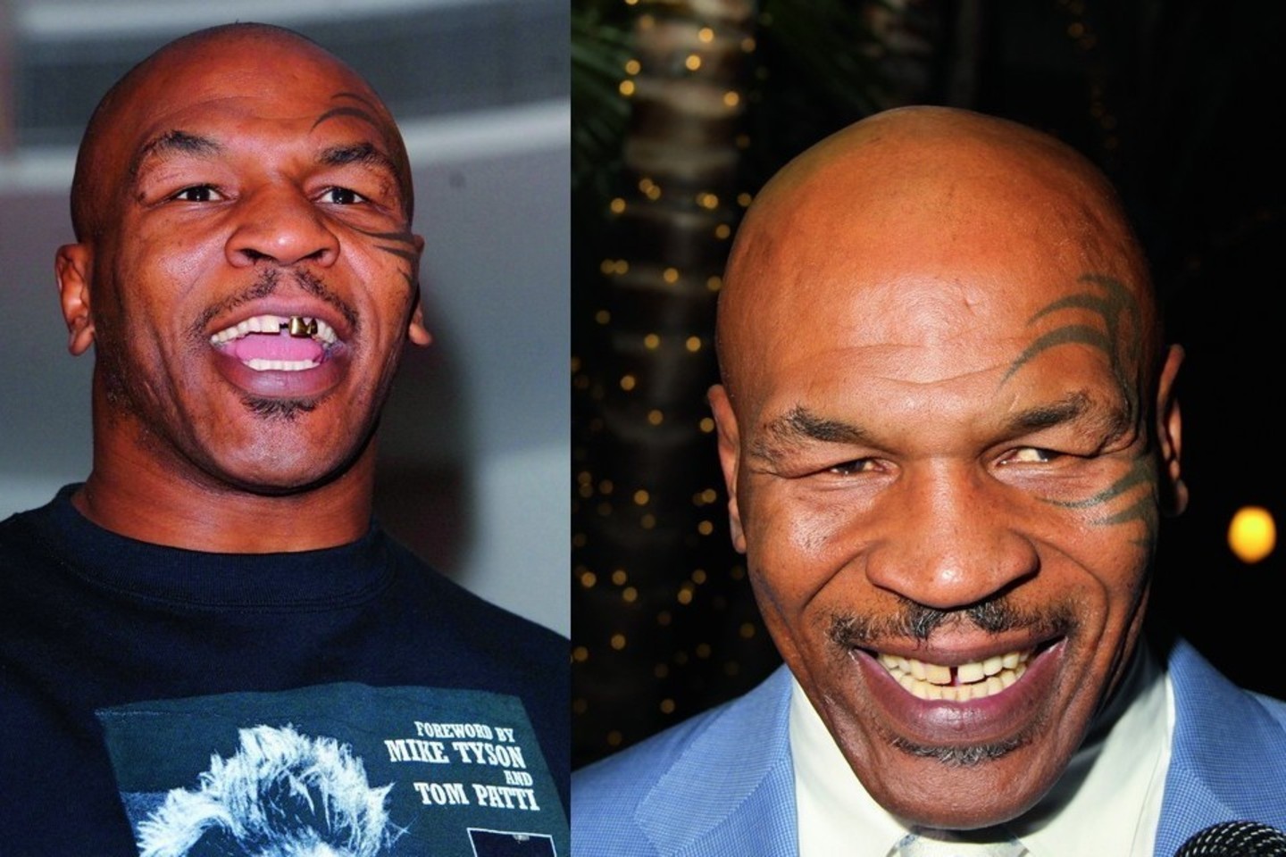 Legendiniam amerikiečių boksininkui Mike’ui Tysonui Dievas nesuteikė įspūdingos šypsenos, tačiau neatrodo, kad Mike’as dėl to jaudinosi. Priešingai – jis visada plačiai šypsodavosi.<br>ViDA Press nuotr.