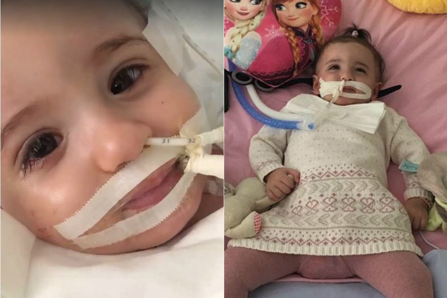 Mažoji Marwa prabėgus vos 10 dienų po jos gyvybės palaikymo pratęsimo.<br>Socialinių tinklų nuotr.