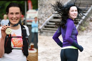 Dėl garsios bėgikės gyvenimo būdo pečiais gūžčioja net medikai