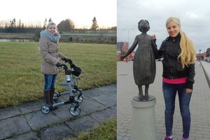 Jonaviškės smegenis ėdanti keista liga griauna ir jos gyvenimą