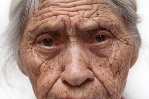 Kaip išvengti nereikalingų raukšlių susidarymo?