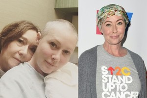 „Beverli Hilso“ aktorė Shannen Doherty leido pažvelgti, kaip gydosi krūties vėžį