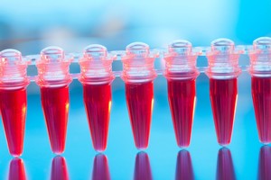 Ar mokate perskaityti bendrąjį kraujo tyrimą? Štai apie kokias ligas galite sužinoti