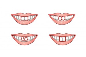 Kokios formos jūsų priekiniai dantys? Tai atspindi asmenybę