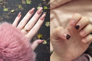 Pamėgta grožio procedūra baigėsi kraupiai – ragina saugotis