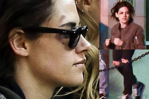 Žvaigždžių savaitėje – mįslė dėl Kristen Stewart traumų