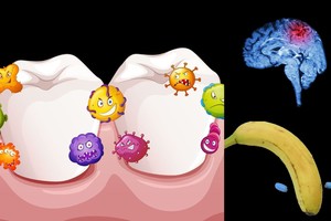 Pamirštate išsivalyti dantis? Turime jums labai blogų žinių