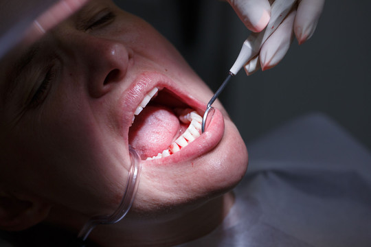 Iš odontologo lūpų: 8 siaubo istorijos sukrėtusios ir visko mačiusius medikus