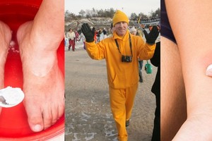 Garsiausio sveikuolio patarimai: apie šiuos sodos panaudojimo būdus buvote pamiršę