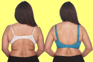 Riebalų raukšlių ant nugaros atsikratysite pasinaudoję šiuo patarimu