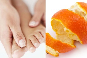 Patrinkite mandarino žievelę tarp pirštų. Dėl poveikio imsite tai daryti nuolat