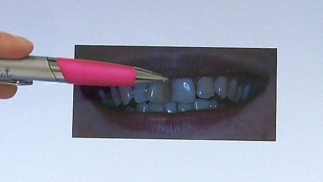 „Namų daktaras“: estetinė dantų restauracija (I)