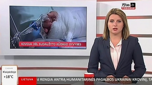 „Reporteris“: medikai kovoja dėl sudaužyto kūdikio gyvybės (I)