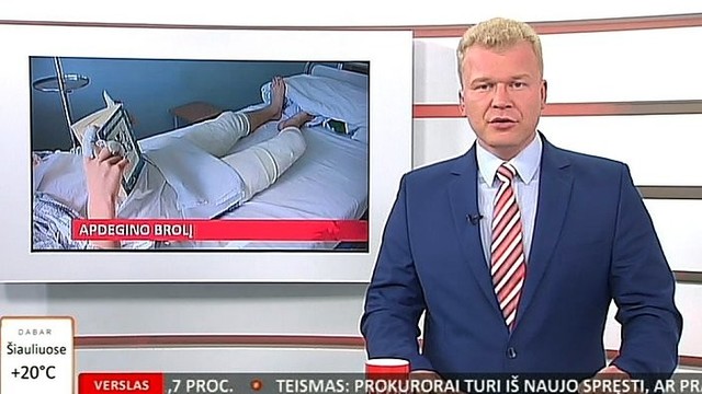 „Reporteris“: paauglys įtariamas apdeginęs jaunesnį brolį (I)