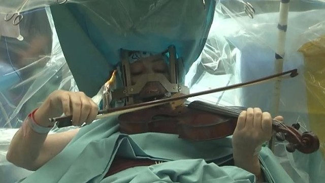 Per operaciją Lietuvą žavėjusi smuikininkė griežė Mocartą