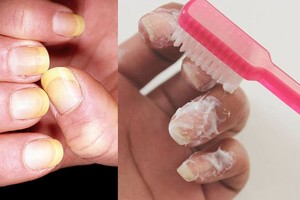 Nagus patepė dantų pasta, o po kelių minučių nustebo