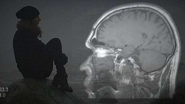 Kas vyksta smegenyse, kai žmogus tariamai mato vaiduoklius? (II)