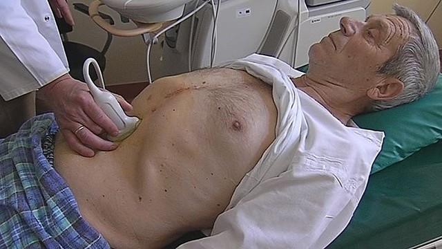 Kodėl pilvo aortos aneurizma – tylioji žudikė? (I)