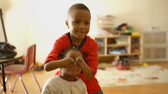 Medicinos galia: berniukui prisiūtos kito žmogaus plaštakos