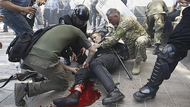 Kruvini neramumai Ukrainoje sukėlė didelę diskusijų bangą